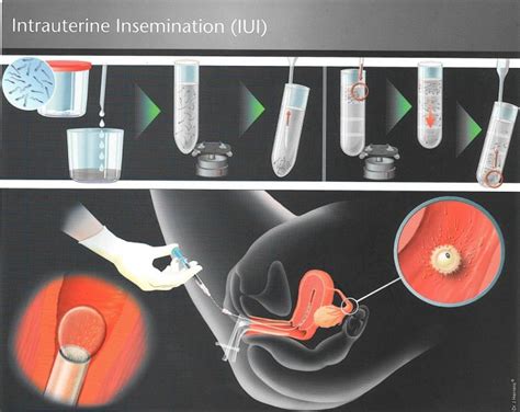 Insemination Porn Videos 